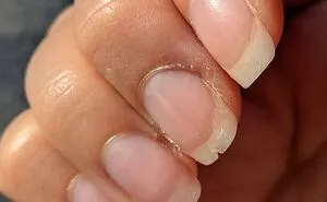 44 Medical Pics That Might Make Even The Most Squeamish Person Curious