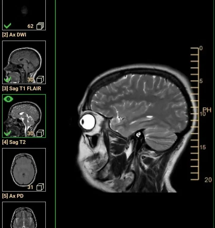 My Mri Got Me Out Here Looking Like Homer Simpson