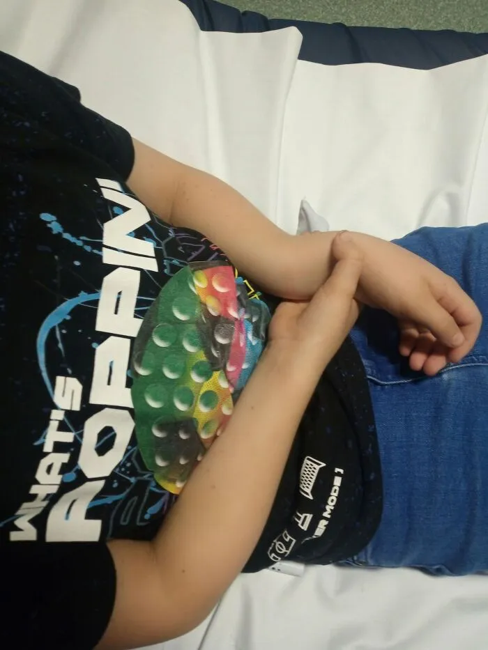 A child lying down showing an injured arm, captured in disturbing medical photos.