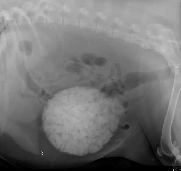 Disturbing medical photos showing an X-ray of a large bladder stone full of smaller stones.