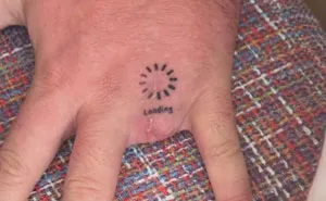 44 Medical Pics That Might Make Even The Most Squeamish Person Curious