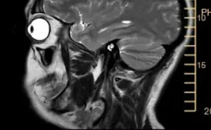 44 Medical Pics That Might Make Even The Most Squeamish Person Curious
