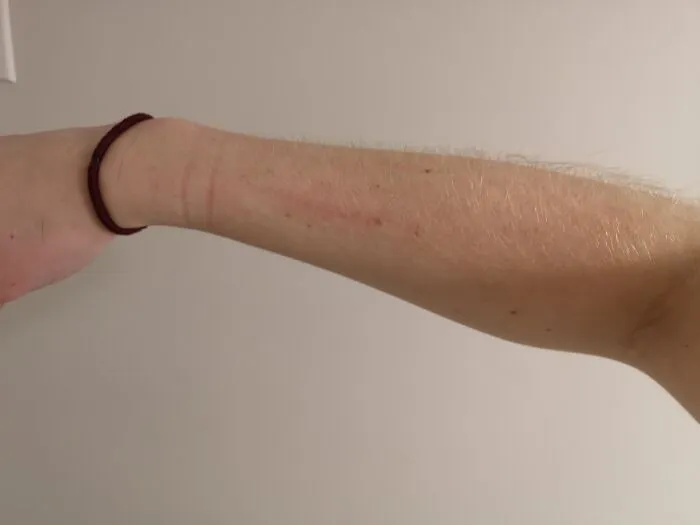 A person showing arm hair highlighting natural facts about women's bodies