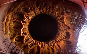 Extreme Close-Ups of the Human Eye