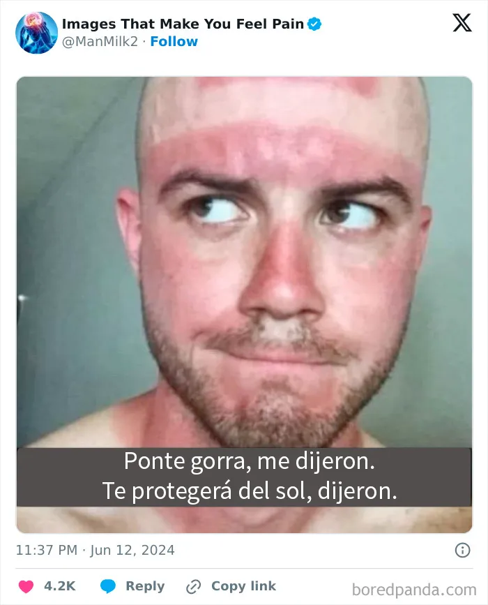 20 Imágenes dolorosas que te quitarán las ganas de seguir mirando internet por hoy