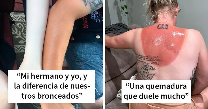 36 Personas que metieron la pata tomando el sol y han aprendido la lección