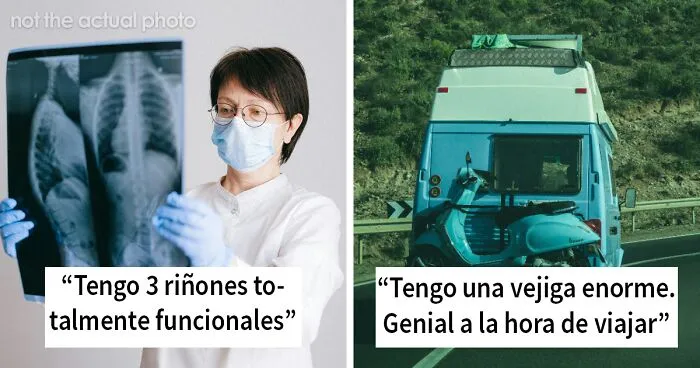 20 Personas bastante únicas que ganaron la lotería genética