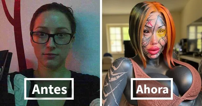 20 Vidas comunes transformadas por cirugías plásticas extremas