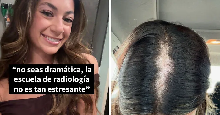 Estas personas comparten 20 fotos de antes y después de que la vida les pasara por encima