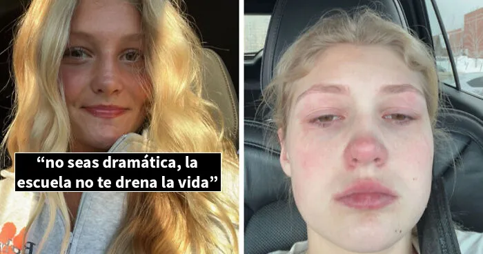Estas personas comparten 20 fotos de antes y después de que la vida les pasara por encima