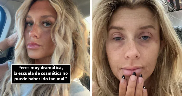 Estas personas comparten 20 fotos de antes y después de que la vida les pasara por encima