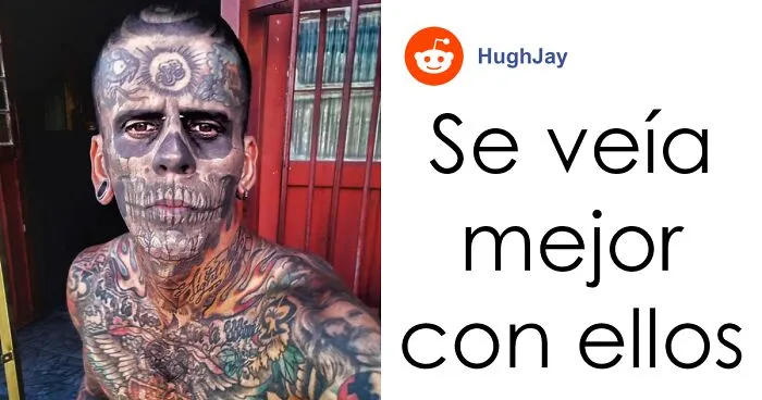 Este hombre se había tatuado el 95% de su cuerpo, pero su aspecto es impactante tras quitárselos con láser