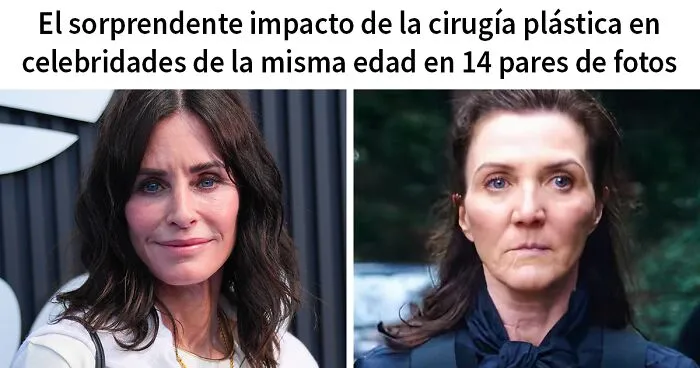 El sorprendente impacto de la cirugía plástica en celebridades de la misma edad en 14 pares de fotos