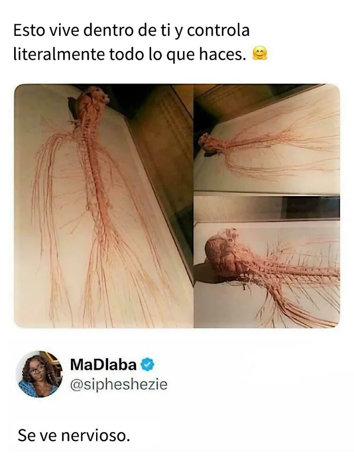 😂😂