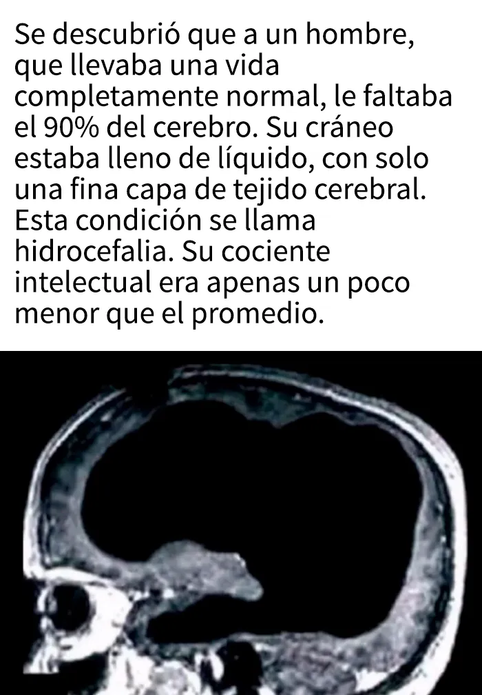 “Perdió la movilidad de las piernas por culpa de las bebidas energéticas”: 15 historias sorprendentes e impactantes