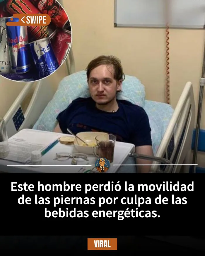 “Perdió la movilidad de las piernas por culpa de las bebidas energéticas”: 15 historias sorprendentes e impactantes