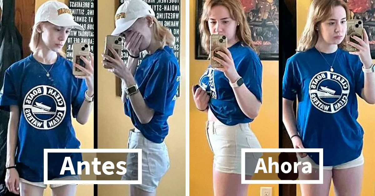 21 Fotos muy interesantes del antes y después que muestran los progresos de la gente