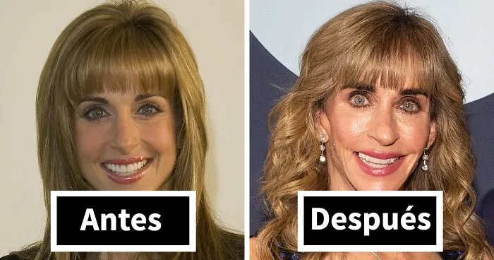 10 transformaciones faciales a lo “Mar-a-Lago” que dejaron a la gente completamente atónita