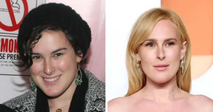 18 fotos de “Antes y después” de celebridades entre 2005, 2015 y 2025, incluyendo a una que quedó “desfigurada”