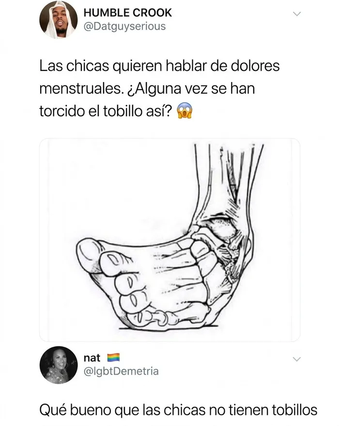 Publicación de Twitter con comentarios más graciosos sobre la ilustración de un tobillo torcido.