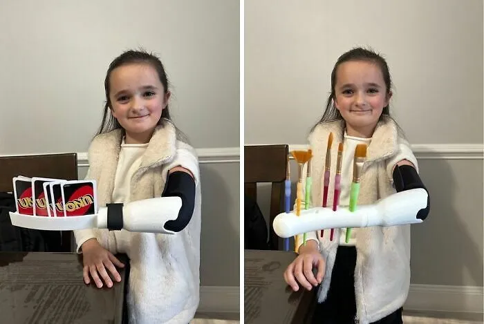 Niña usa prótesis impresa en 3D para jugar cartas y pintar, cosas tan curiosas como maravillosas.