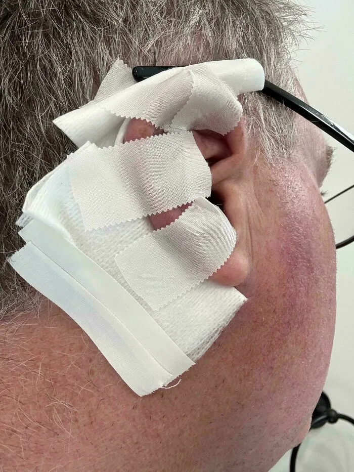 Oreja vendada con cinta médica tras un accidente en un mal día.