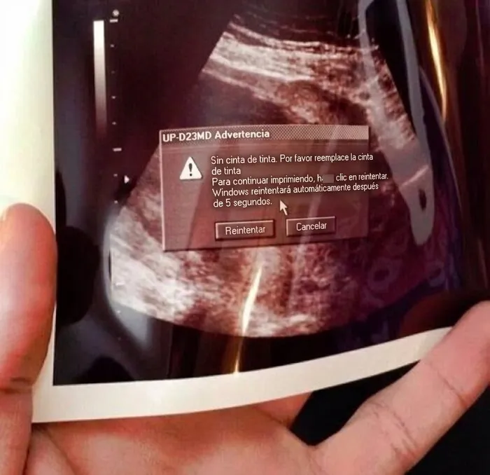 Error de impresión en ecografía, ejemplo de pifiaron con una sola cosa que hacer