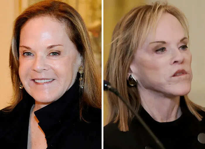 Cambios faciales notables en mujeres relacionadas con Trump