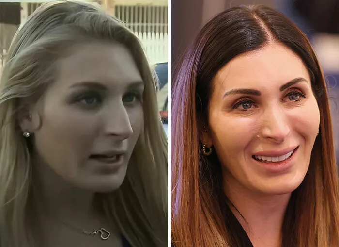 Cambios en rostro de mujer del círculo de Trump y polémica de la cara MAGA