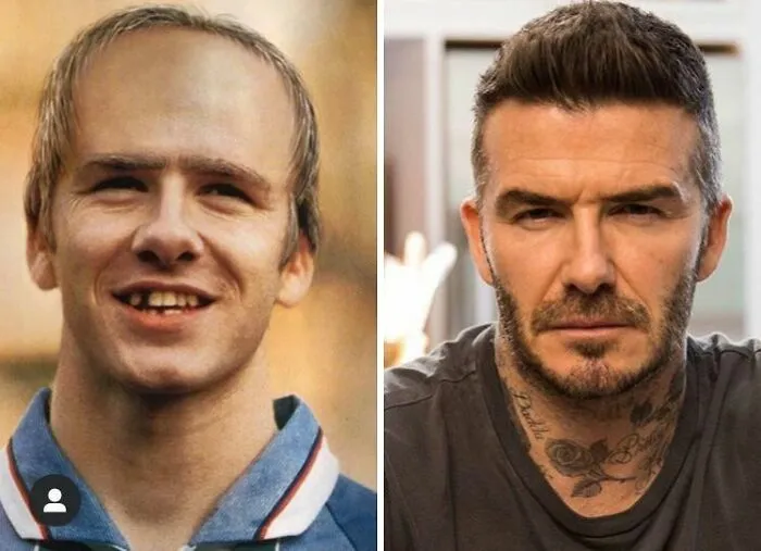 Comparación de fotos de David Beckham joven y adulto mostrando cambio drástico