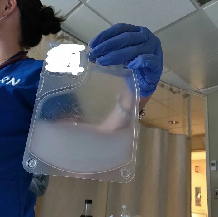 Persona con guantes sosteniendo bolsa médica transparente en hospital