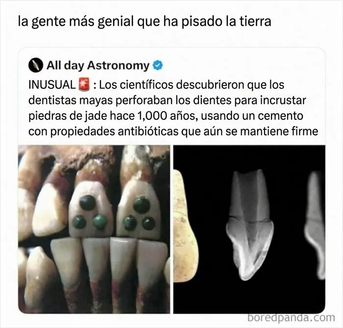 Radiografías y dientes mayas con incrustaciones de piedra de jade y cemento antibiótico