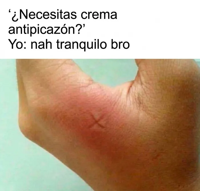 Meme de marca en forma de X en picadura de mosquito explicada