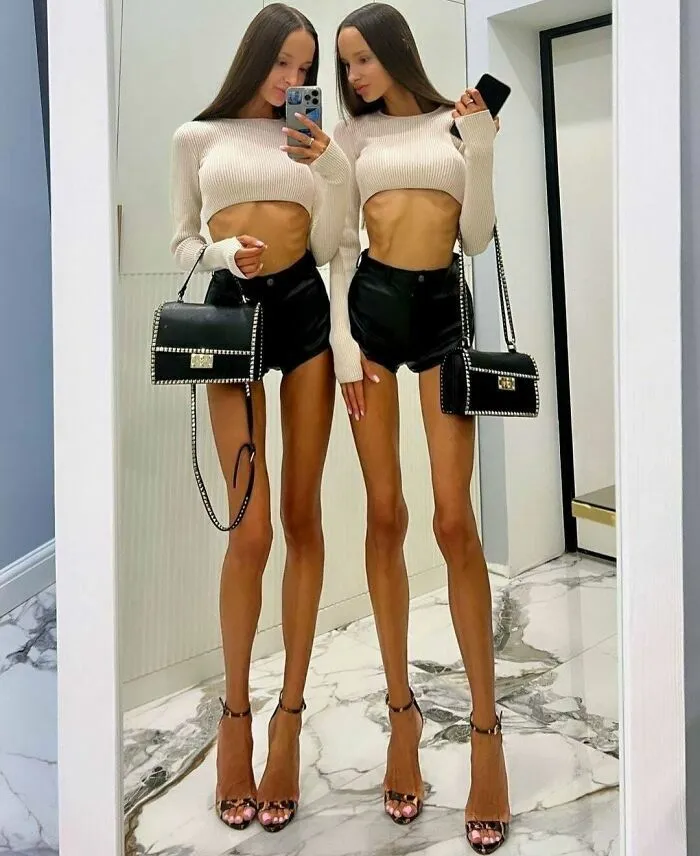 Dos mujeres con piernas alargadas por fotos tan retocadas que distorsionan el cuerpo.