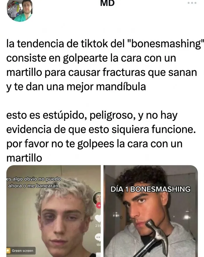 Personas demostrando ignorancia en TikTok al seguir la peligrosa tendencia de bonesmashing.
