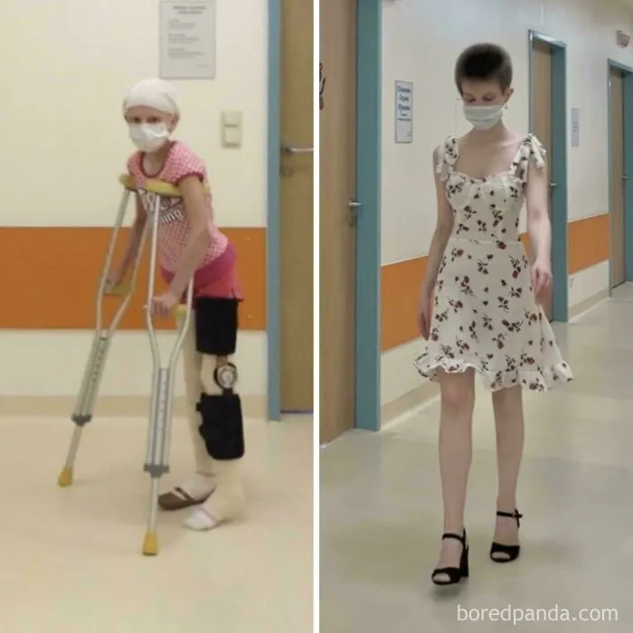 Antes y después de una recuperación, una de las publicaciones reconfortantes de superación personal