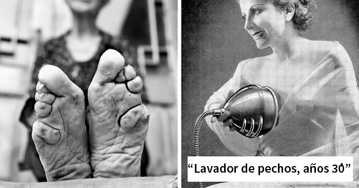 26 Cosas inimaginables que hacían antes las mujeres para estar más "bellas"