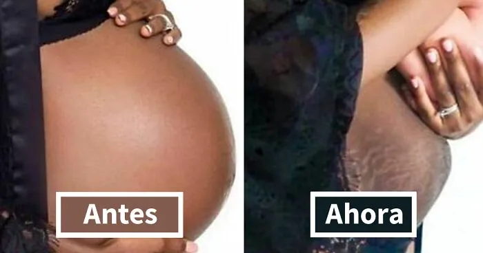 20 Fotos honestas de cuerpos postparto compartidas para mostrar la verdad de la que apenas se habla (nuevas fotos)