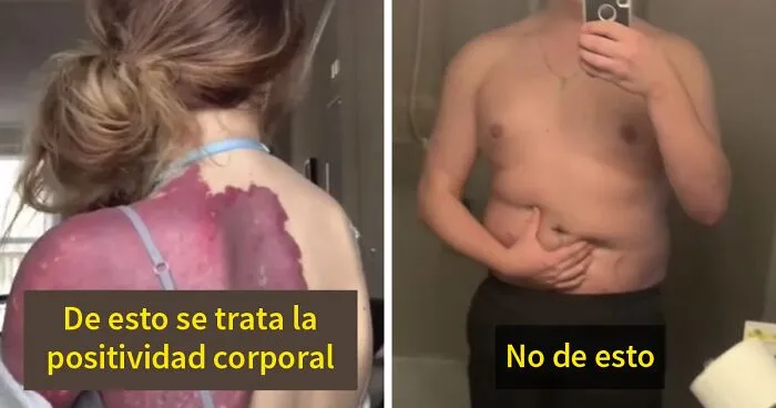 "No hay nada positivo en esto": Este chico explica cómo la gente no debería celebrar los cuerpos de "talla grande"