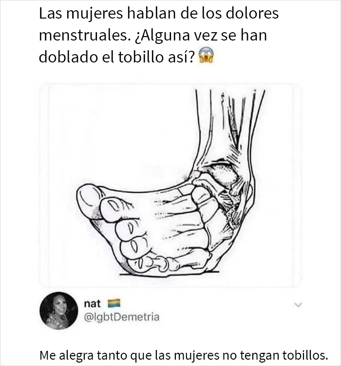 Las mujeres no tienen tobillos