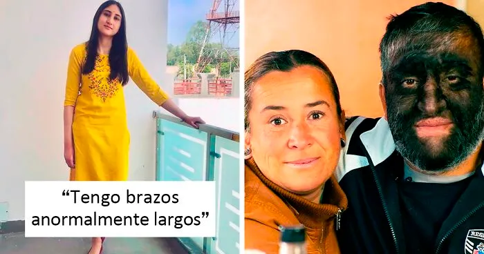 45 Personas únicas mostrando lo impredecible de la genética (nuevas fotos)