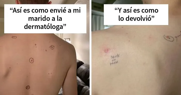 Esta esposa marcó los lunares de su marido antes de que fuera al médico y volvió con notas en su cuerpo