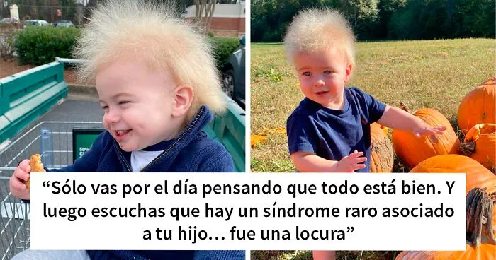 A este alegre niño se le diagnosticó el síndrome del cabello impeinable