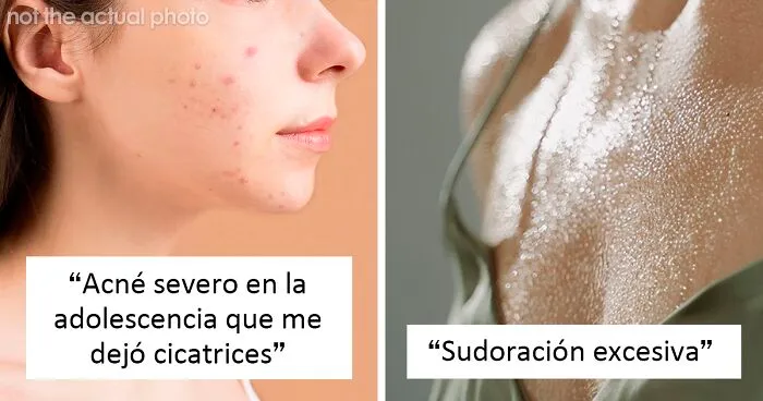25 Personas que no tuvieron suerte en el reparto de los genes