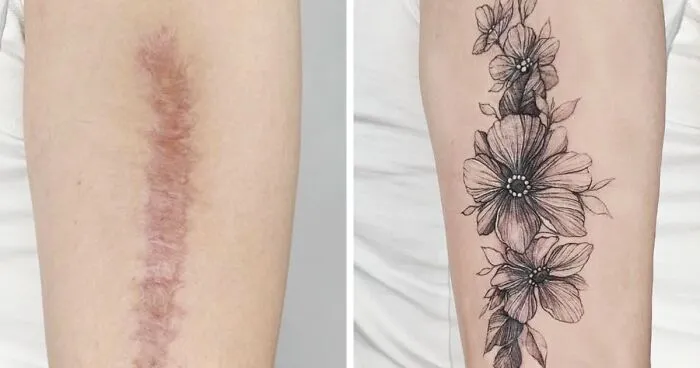 40 Personas que querían tapar sus cicatrices, y esta tatuadora lo consiguió (nuevas fotos)