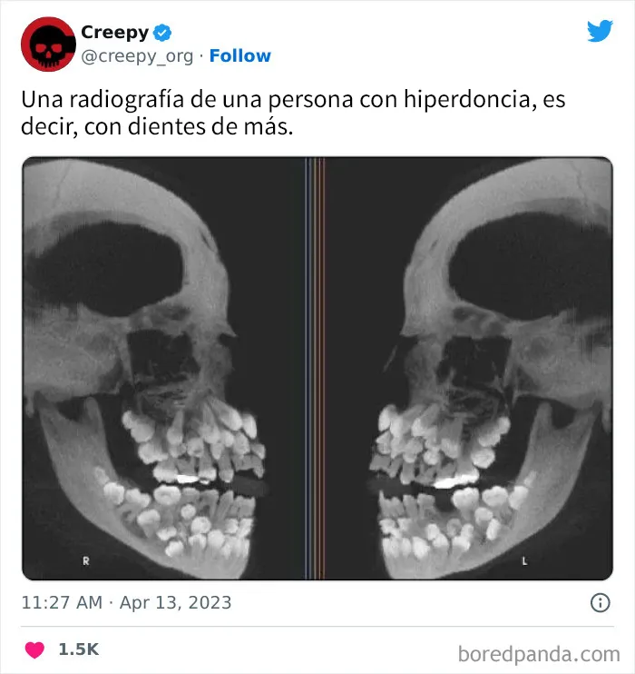 20 Escalofriantes publicaciones que te harán debatirte entre apartar la vista de la pantalla o seguir mirando hasta el final