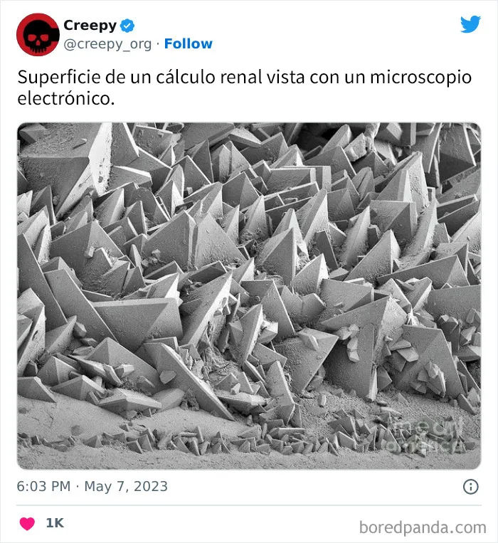 20 Escalofriantes publicaciones que te harán debatirte entre apartar la vista de la pantalla o seguir mirando hasta el final
