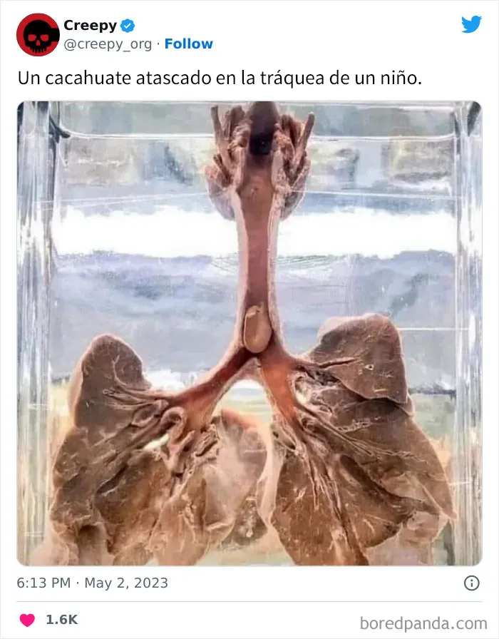 20 Escalofriantes publicaciones que te harán debatirte entre apartar la vista de la pantalla o seguir mirando hasta el final