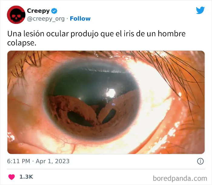 20 Escalofriantes publicaciones que te harán debatirte entre apartar la vista de la pantalla o seguir mirando hasta el final