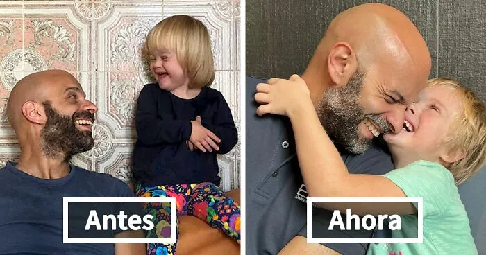 Este padre soltero adoptó a una niña con síndrome de Down, y está creciendo maravillosamente